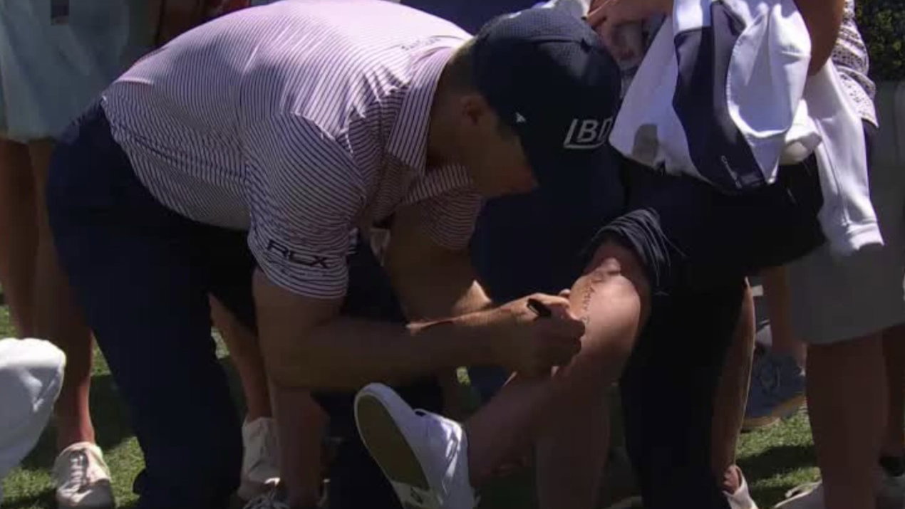 Billy Horschel signs a lady's shin 