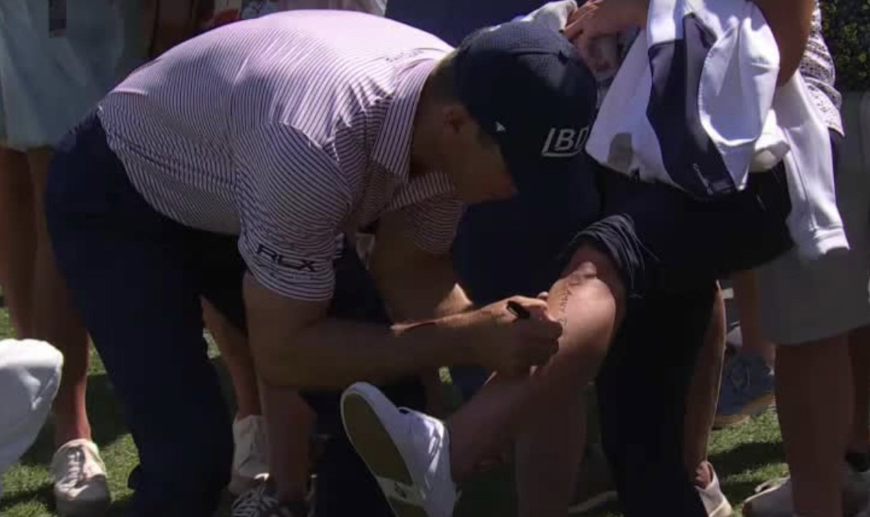 Billy Horschel signs a lady's shin 