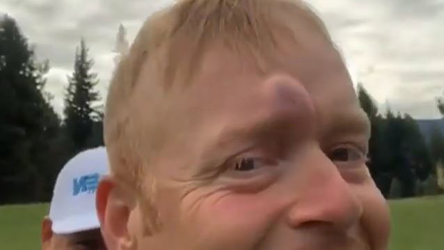 WATCH: Golfer gets a nasty bump on his head after being hit by a golf ball!