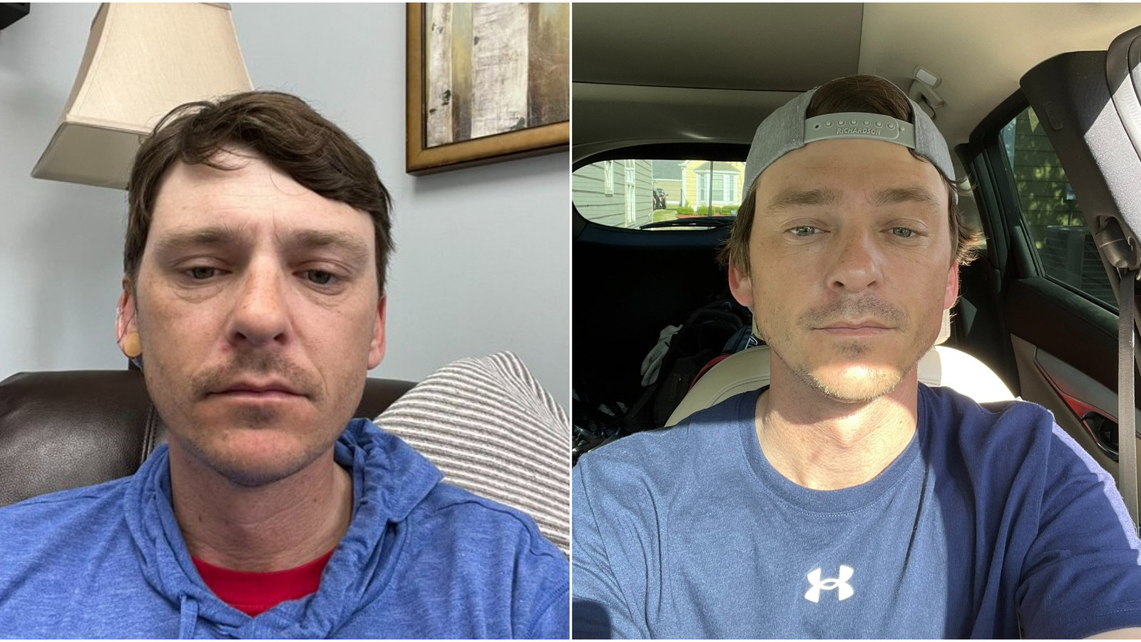 Former PGA Tour player posts haunting image showing effects of drugs